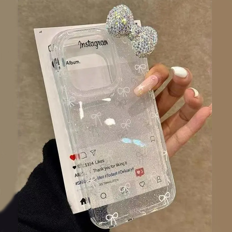 Funda de teléfono con lazo de  - Luxury Watch Case reseña y precio
