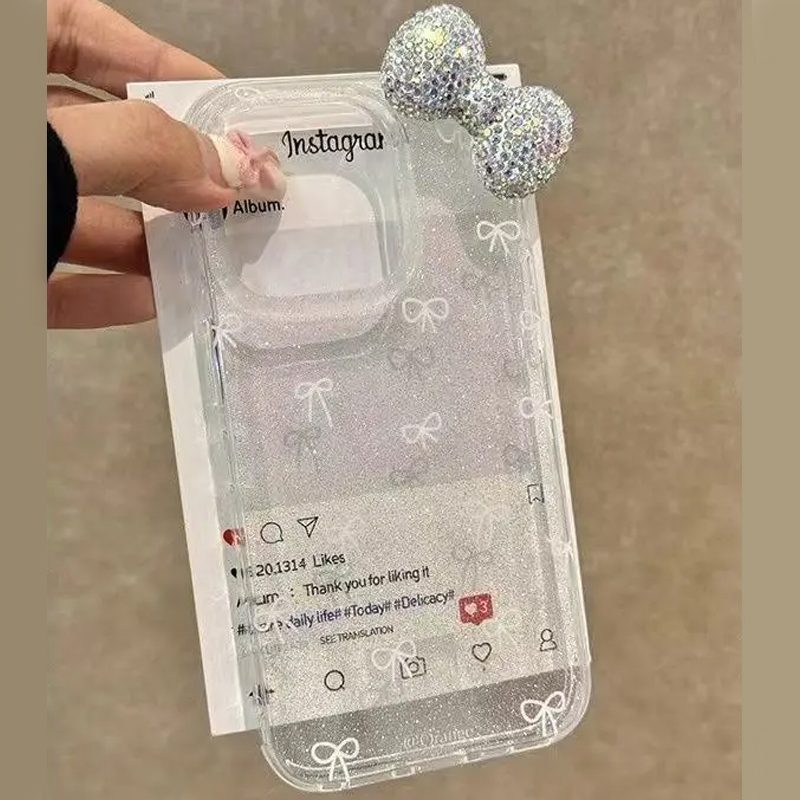 Funda de teléfono con lazo de  - Luxury Watch Case reseña y precio