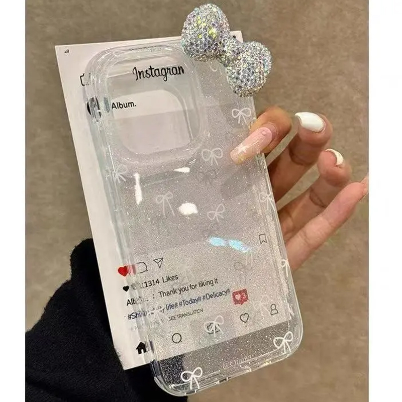Funda de teléfono con lazo de  - Luxury Watch Case reseña y precio